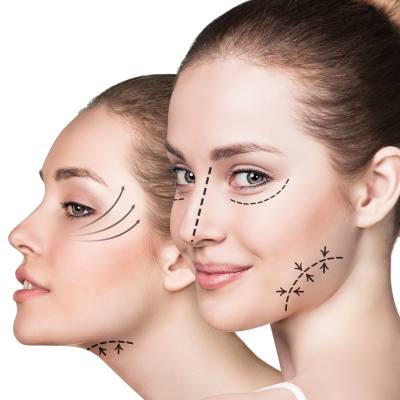 Plastic Surgery Information - What to Know Before Getting Surgery
