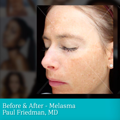 Stop Signs Of Aging BEFORE They Start