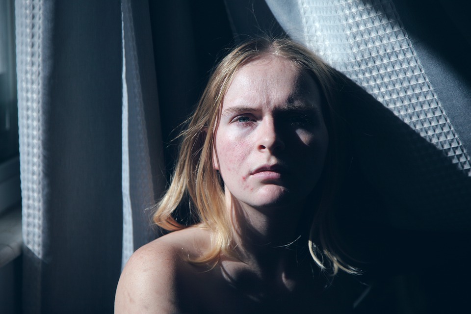 Treatment Options For Body Acne - Prejuvenation Article Banner