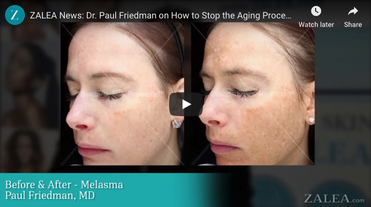 The Trick To Stop Signs Of Aging BEFORE They Start - Prejuvenation Article Banner