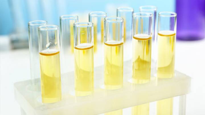 depistage chlamydia
