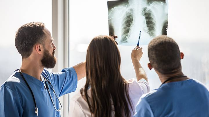 Drei Ärzte analysieren das Lungenröntgenbild eines Patienten, der durch Zigarettenkonsum an COPD erkrankt ist.