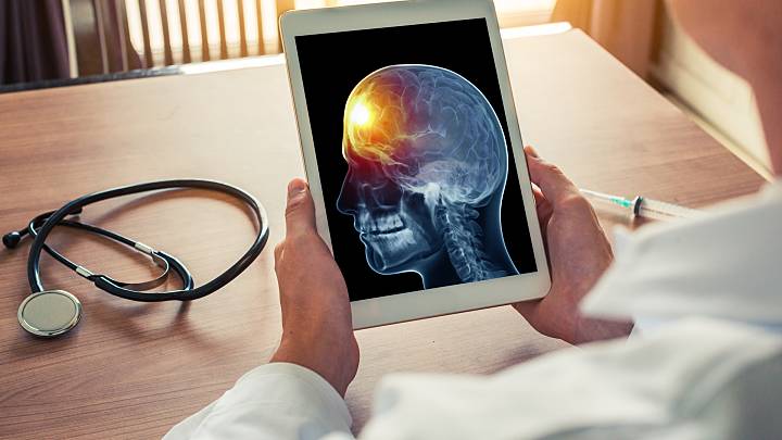Arzt schaut auf ein Tablet, auf dem das Röntgenbild eines Kopfes zu sehen ist