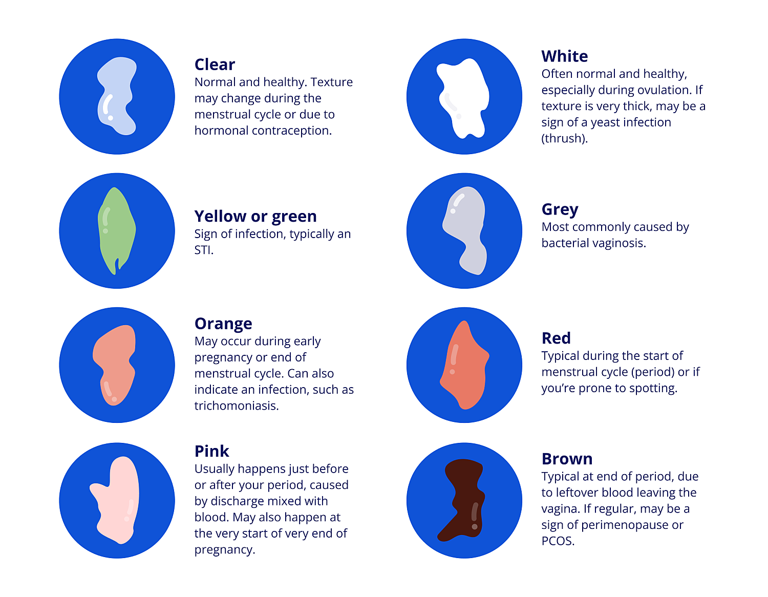vaginal discharge colour chart