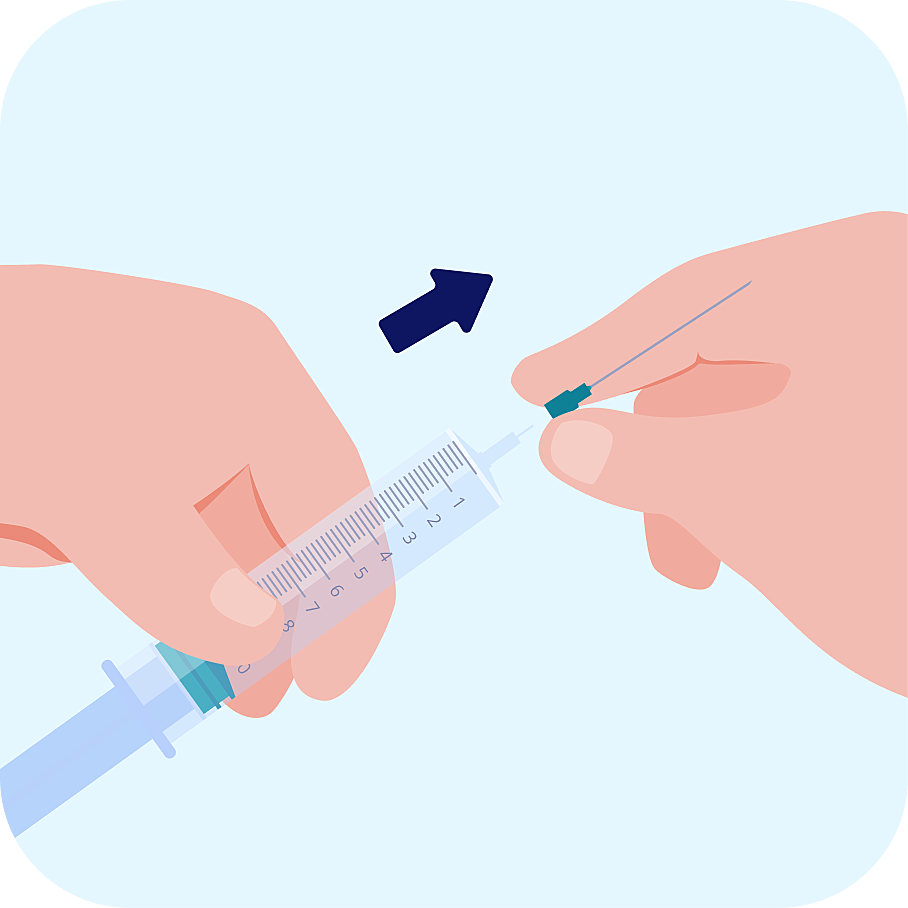 Illustration injection intracaverneuse retrait de l'aiguille