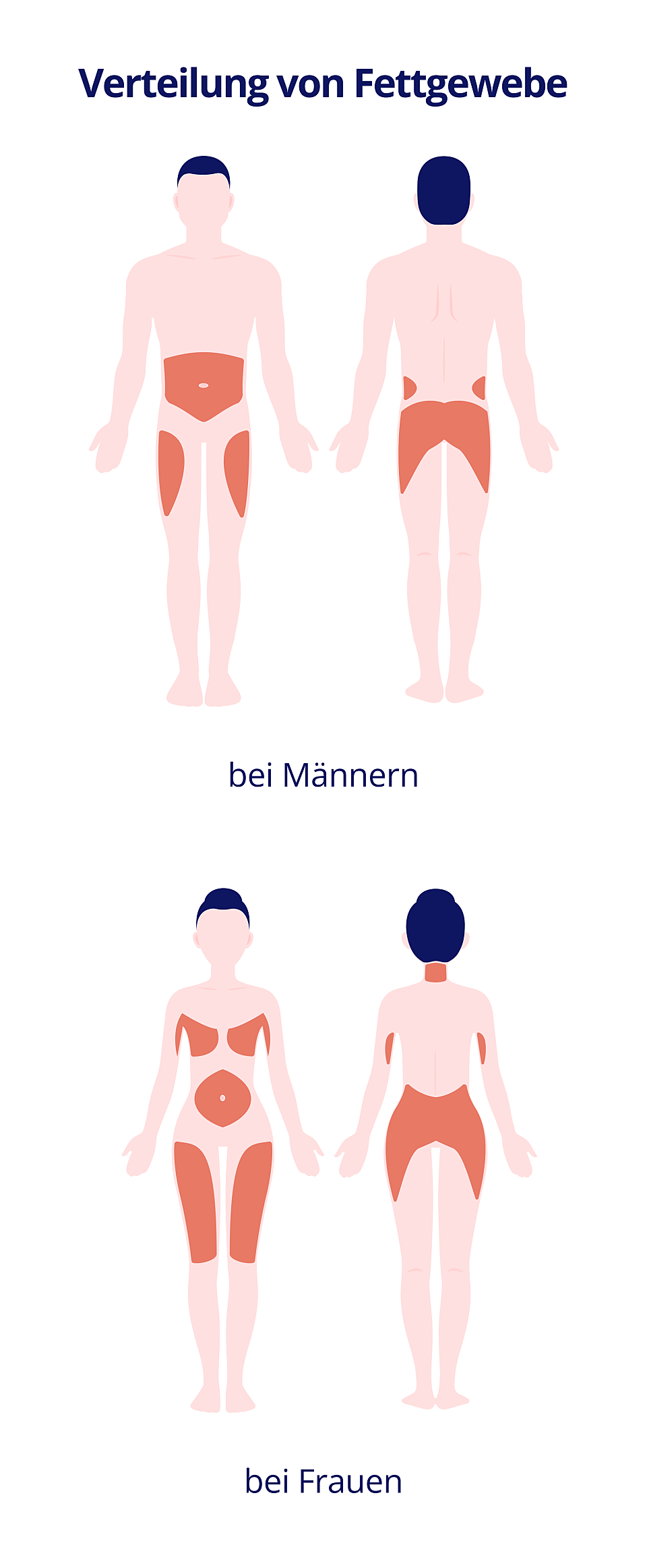 Wie die Verteilung von Fettgewebe aussieht. Bei Männern hauptsächlich am Bauch, den Oberschenkeln und dem Po. Bei Frauen an den Oberschenkeln, Po, Bauch, Brüsten und Nacken