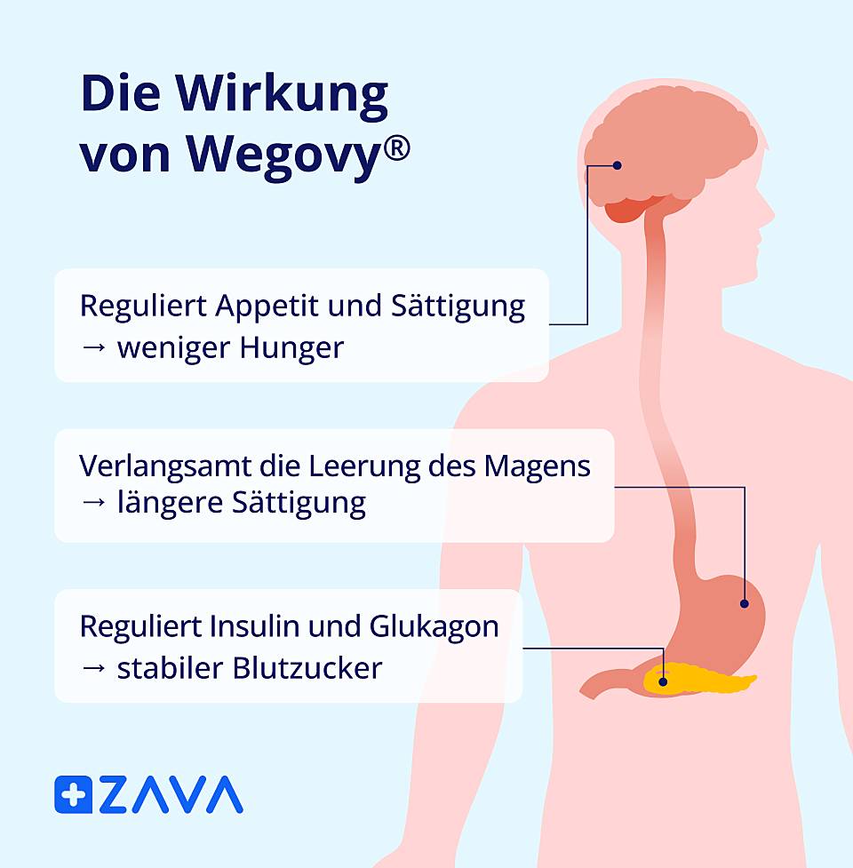 Grafik zur Wirkung von Wegovy® mit Darstellung von Gehirn, Magen und Bauchspeicheldrüse sowie den Effekten auf Appetit, Magenentleerung und Blutzucker.