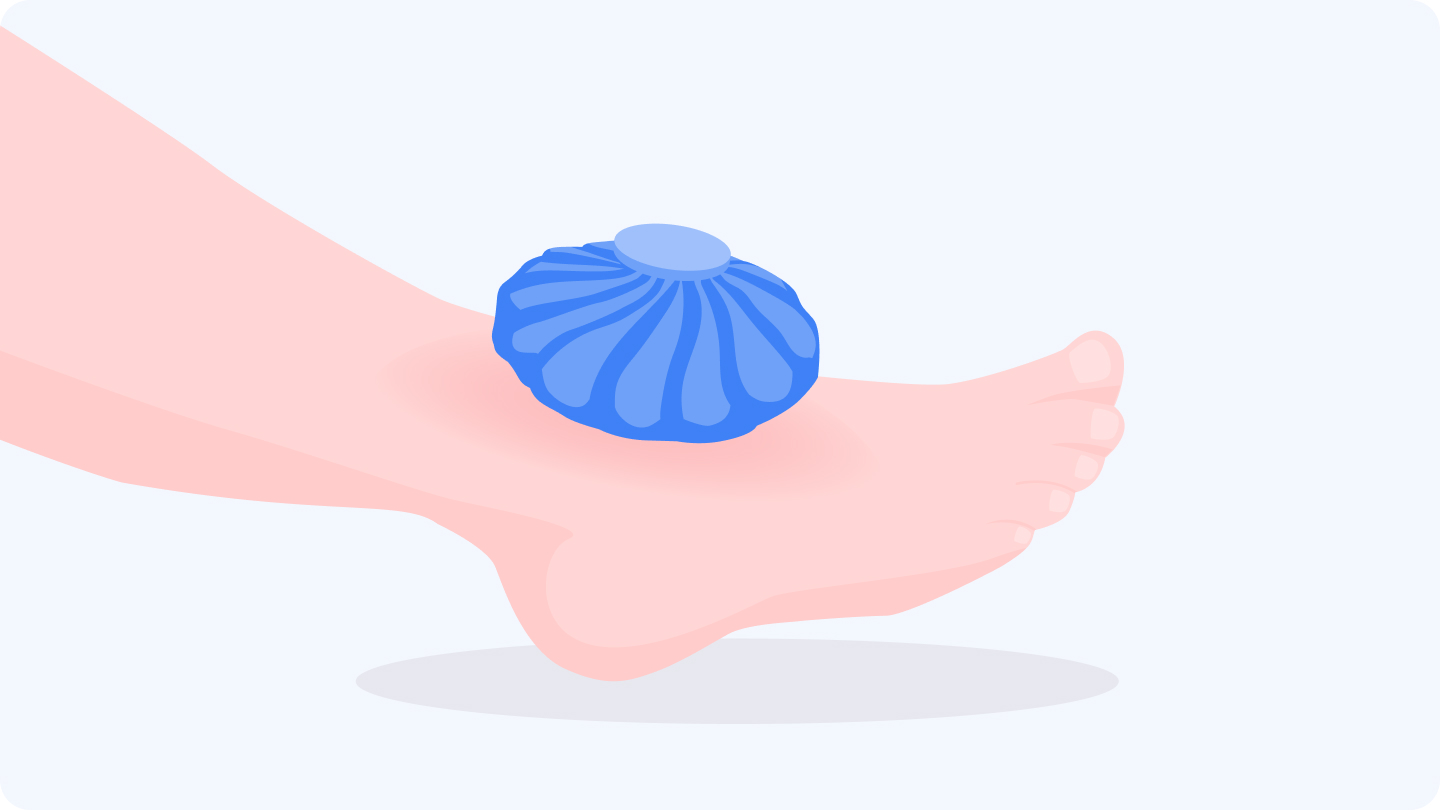 How to treat symptoms of Ozempic feet