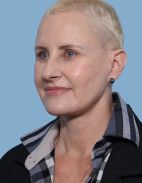 Facelift after - oblique left