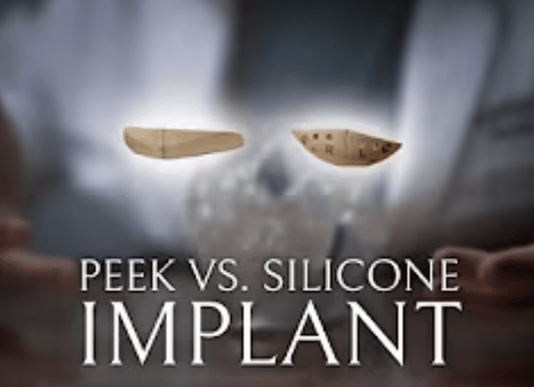 Silicone vs. PEEK Chin Implants: Which One is Right for You?