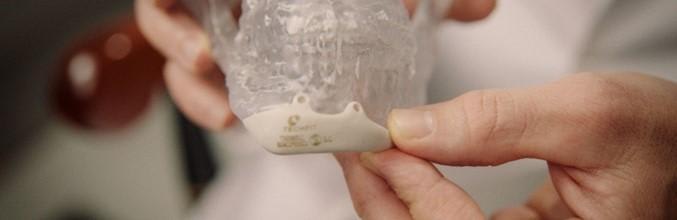 Why Do Patients Seek Custom Jaw Implants After Orthognath...