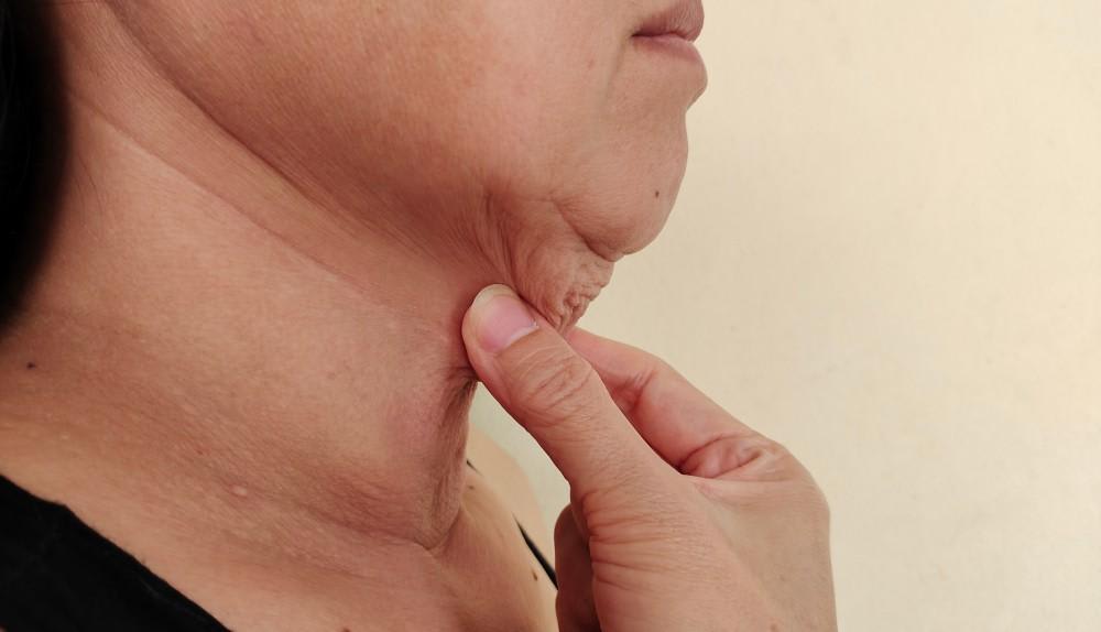 What Can You Do About My Sagging Neck?