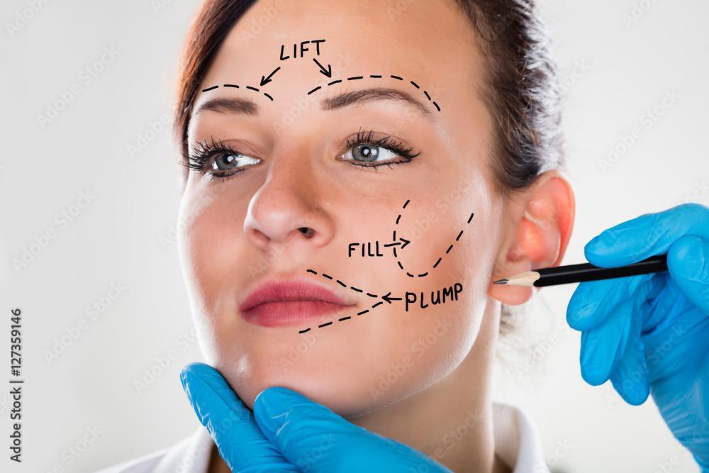 Demystifying Facelifts — Why No Two Should Be Alike