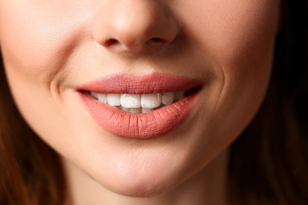 Why Cheek Implants are Enjoying an Increase in Popularity