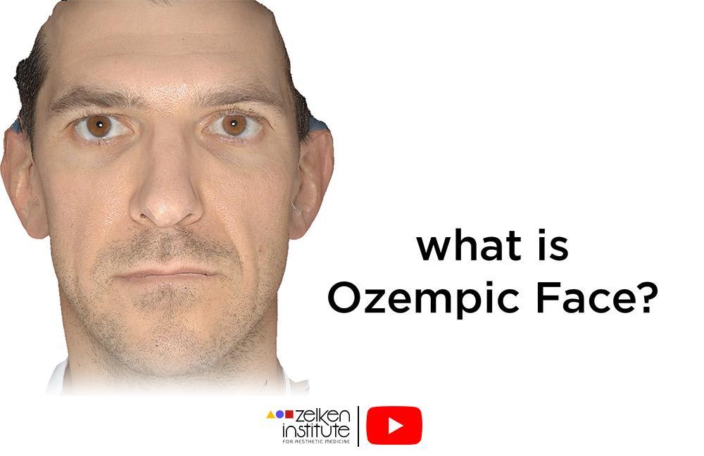 This is What Ozempic Face Looks Like | Facial Wasting Aft...