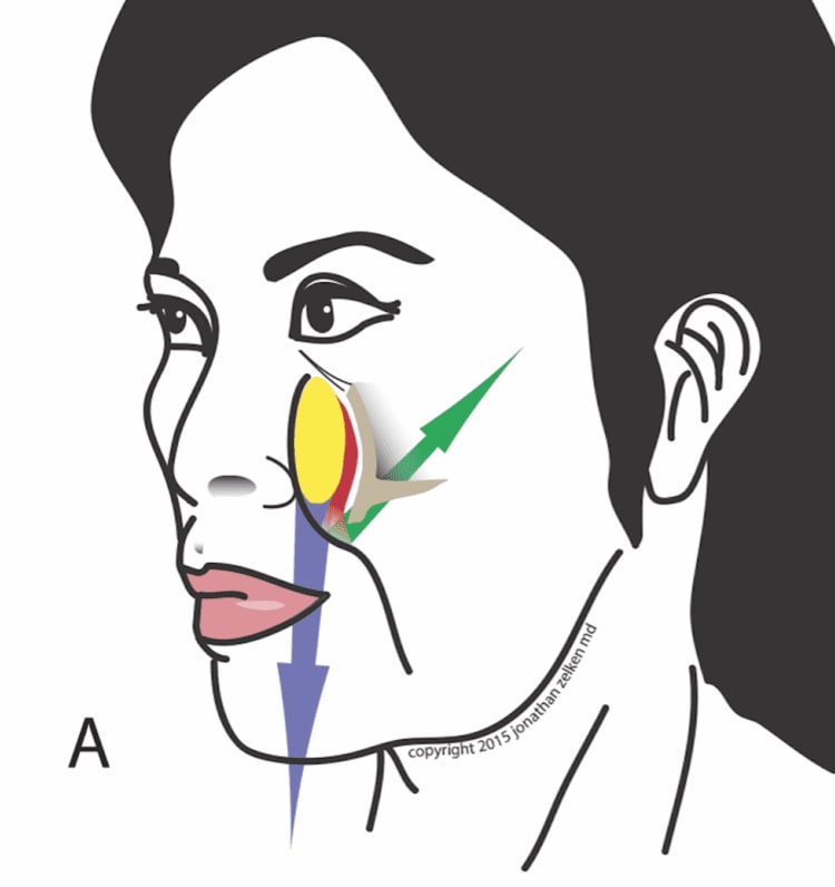 Why Reconstructive Surgeons Are Better Aesthetic Surgeons