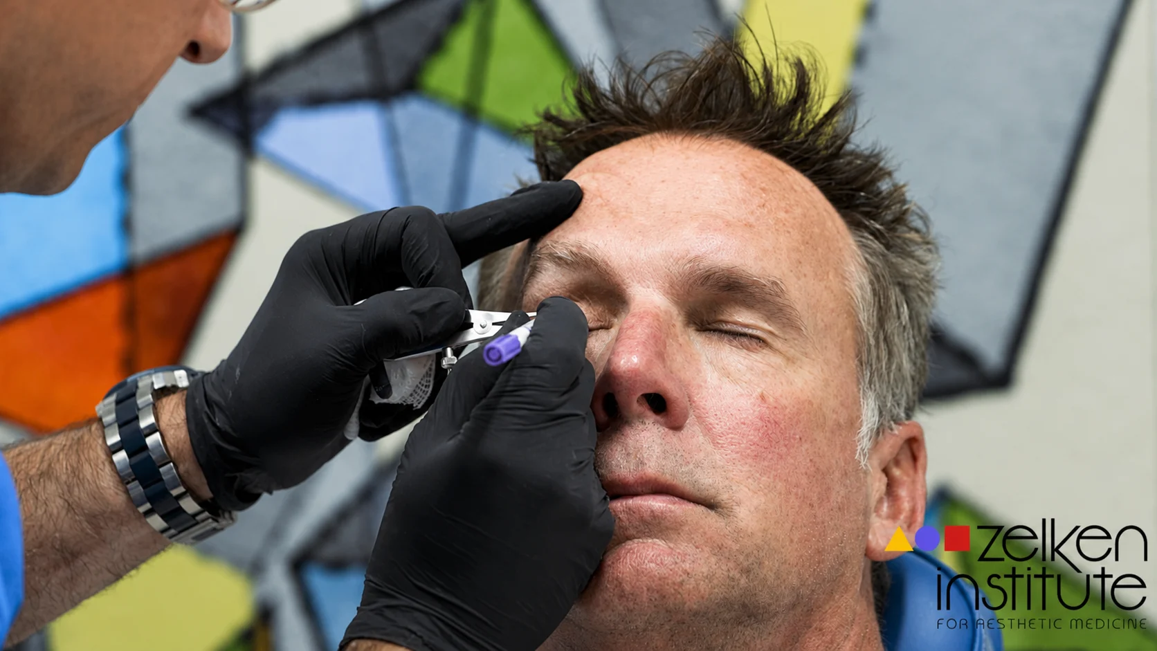 Chuck Finley Undergoes Blepharoplasty with Dr. Jonathan Zelken, Newport Beach Plastic Surgeon