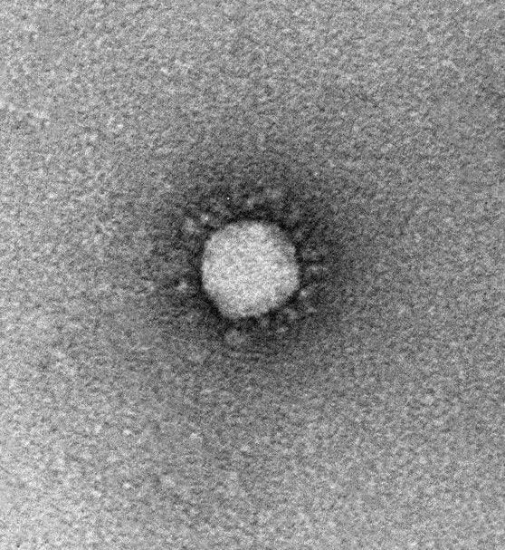 covid-19 virus image