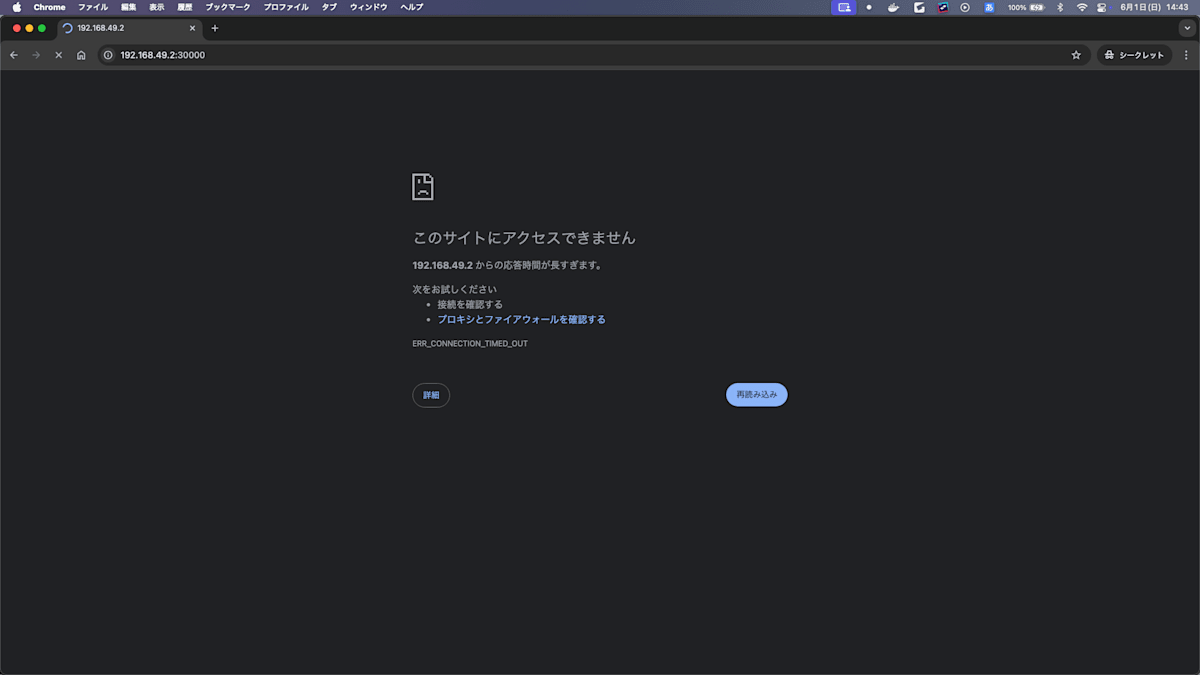 access-loop