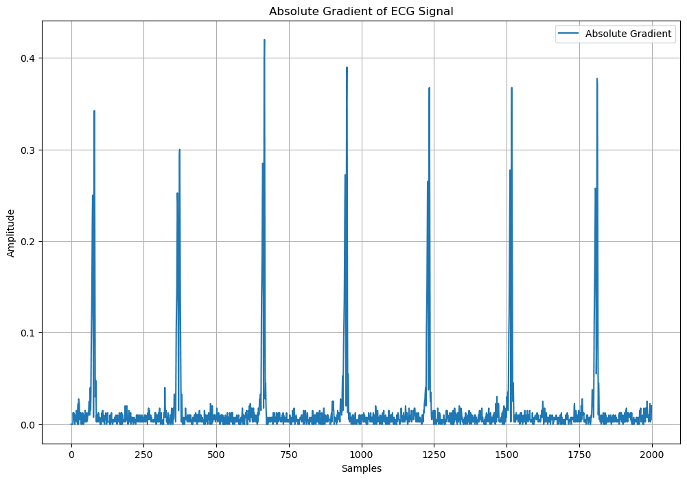 ECG absolute gradient