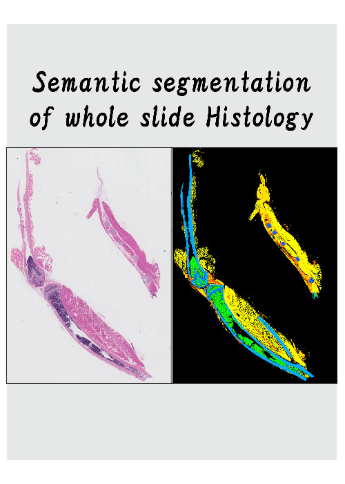 深層学習モデルでバーチャルスライドのSemantic segmentation