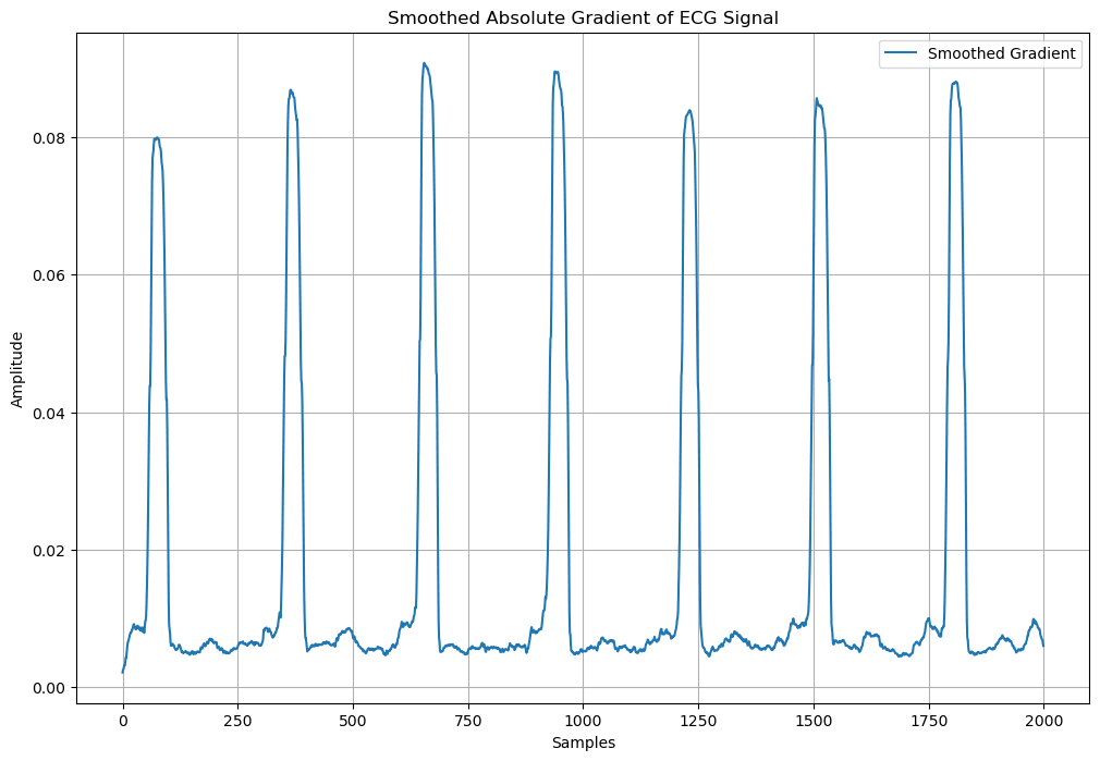 ECG smoothing