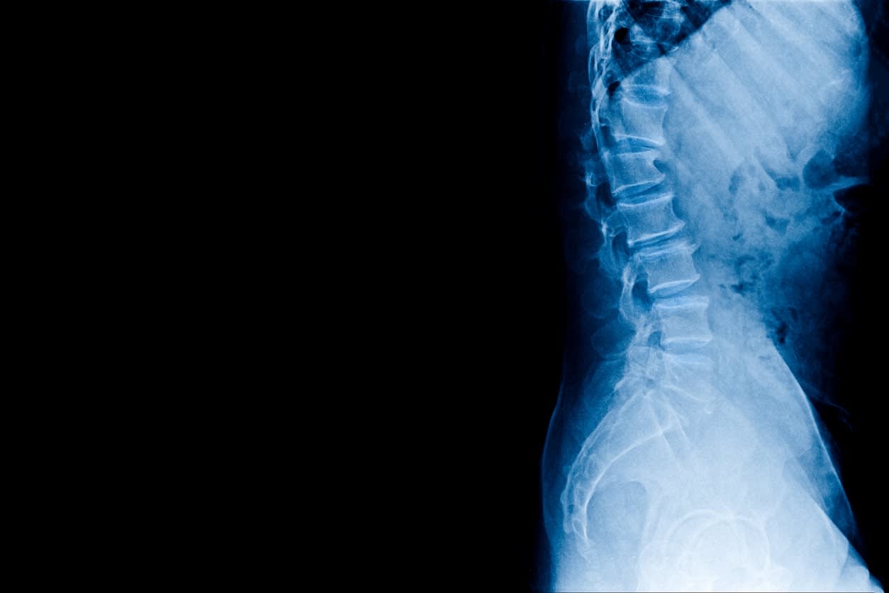 l4-l5-disk-pain-min