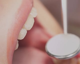 Riverside No Gap Dental