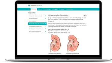 Online keuzehulp