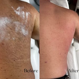 Back Wax