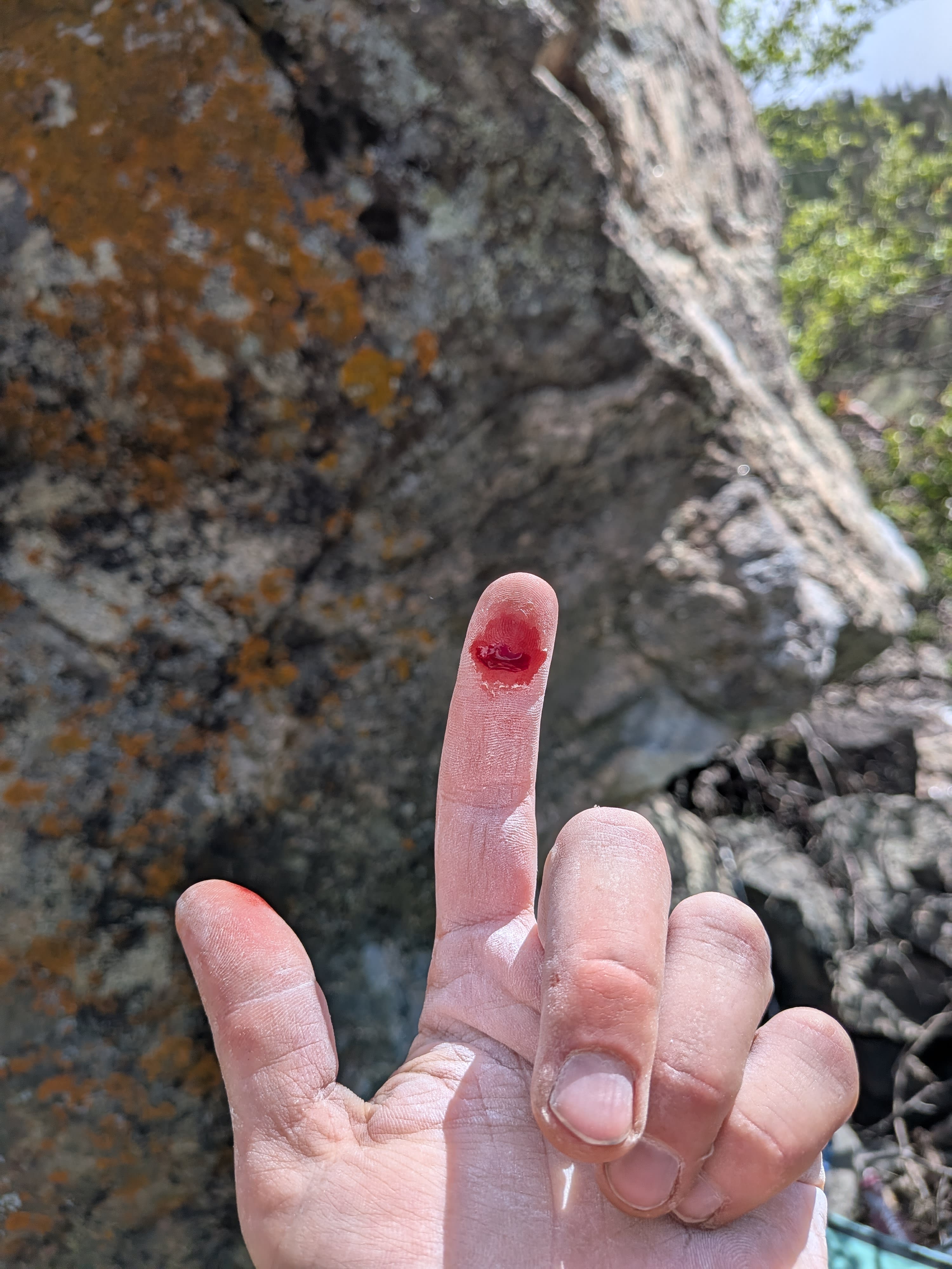 Close-up of a chalky, scraped finger after climbing